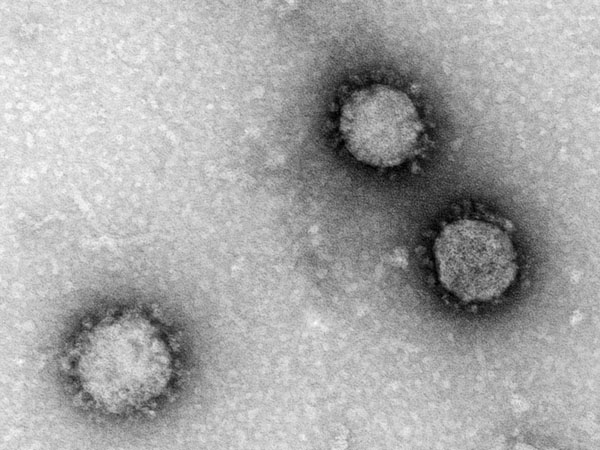 Corona-Virus. Quelle: Hans R. Gelderblom, Freya Kaulbars/RKI